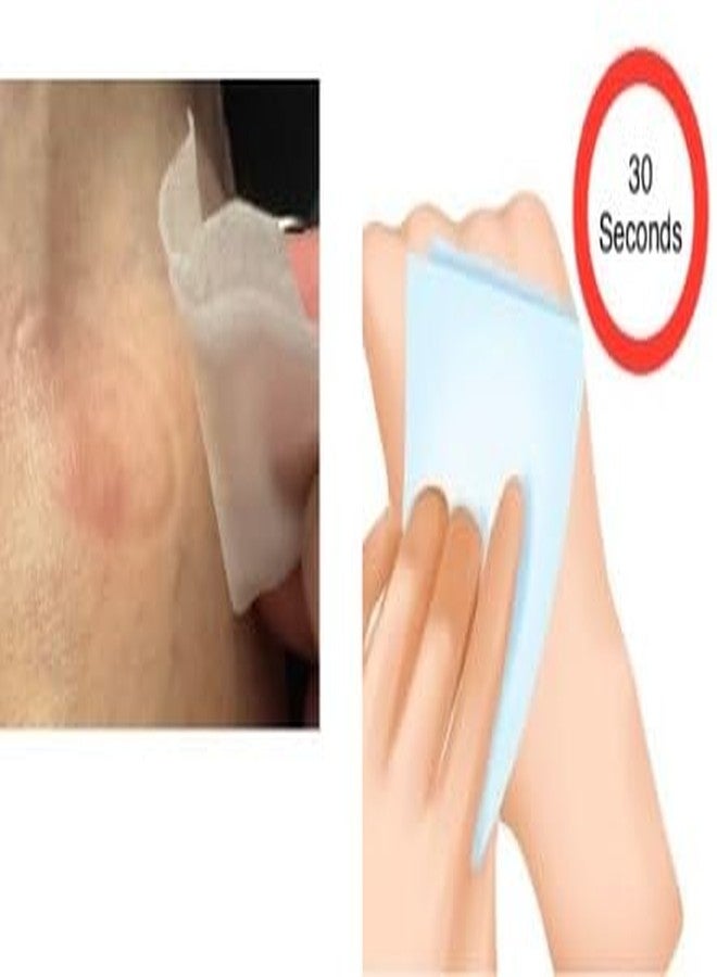Bridge Cutters Musquito Suckquito Itching Reducer Suction Tool Bug Bites Bee Wasp Stings Natural Insect Bite Relief Venom Extractor Outdoor Relief First Aid Camping, Hiking Backpacking Reduce Itch & Swelling - Image 5